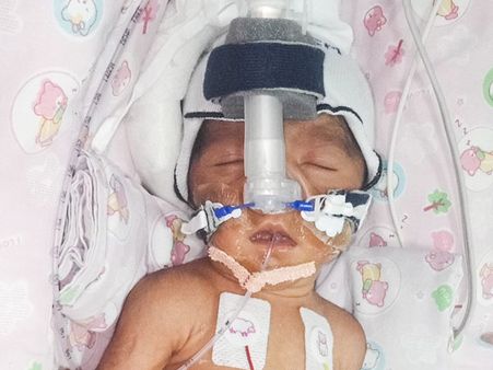Driver’s premature baby girl waits for treatment in NICU
