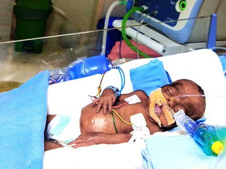 After losing one child, this father fights to save his newborn daughter