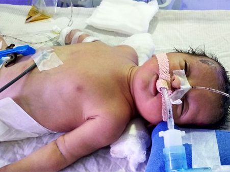 Help Lakshmi In Saving Her Newborn!