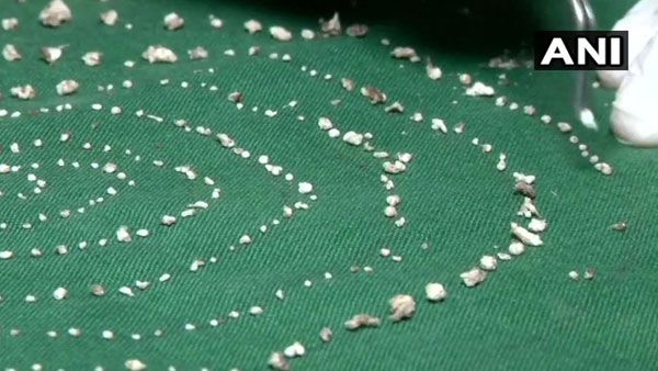 Doctors extract 526 teeth from seven-year-old boy’s mouth