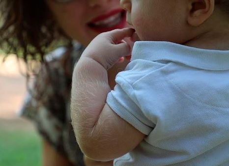 Medicine company whose negligence affected children with ‘werewolf syndrome' has supplier in India