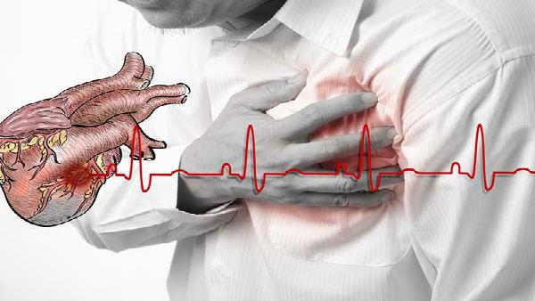 Cardiac abnormalities in COVID-19 patients treated with hydroxychloroquine: Study