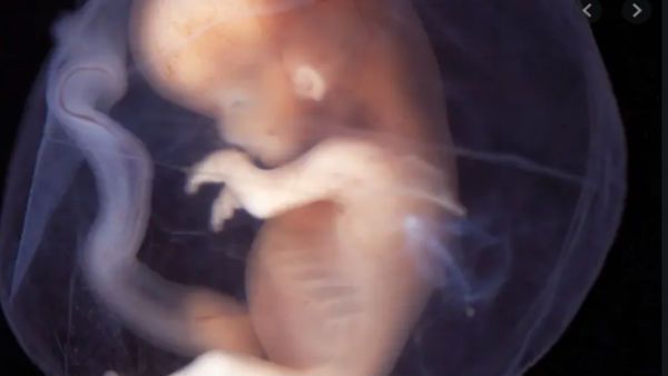 Human embryos, gametes, and gonad tissues exports allowed with condition