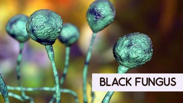 Black fungus cases among Covid patients rise in Bengaluru; K'taka govt seeks details about