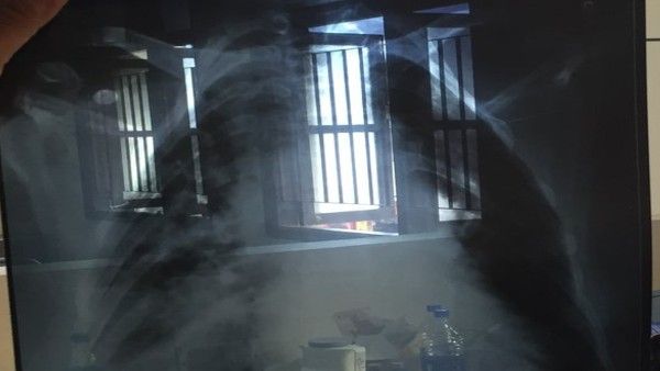 40-year-old man suffering from tuberculosis dies on Shramjeevi Express train