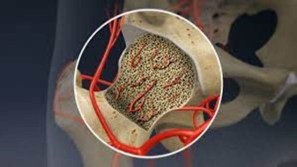 Long Covid: Now steroids-linked 'bone death' a new worry: What are the symptoms of avascular necrosis?