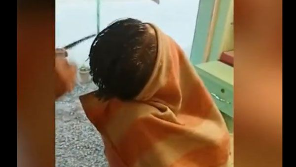 Youth lands in burns ward after a fiery haircut: Watch