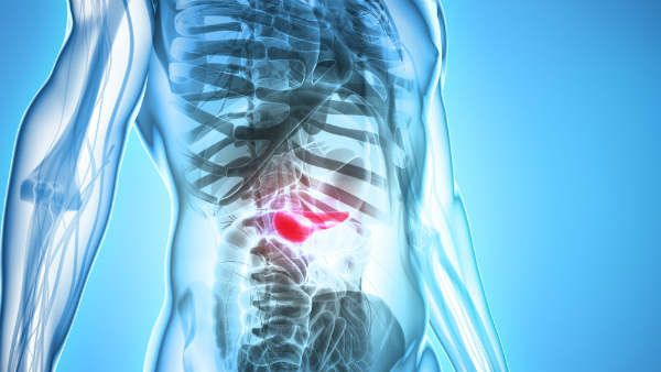 Most pancreatic cancer diagnosed too late to be cured: Study