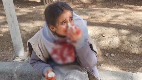 Video of little girl hit in Iran and her nose bleeding goes viral