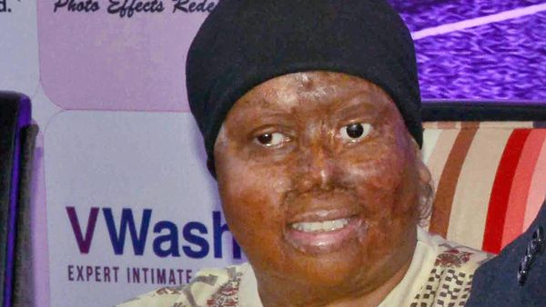 #IWontBlink: Denied Bank Account, Acid Attack Survivor Seeks Justice