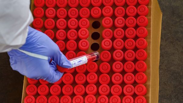 BA.2.86 Variant: 5 Early Signs And Symptoms Of New Covid-19 Viral Strains Pirola To Watch Out For