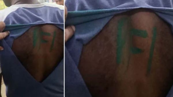 Army Jawan Arrested By Kerala Police For False Claim Of PFI 'Attack' On Him