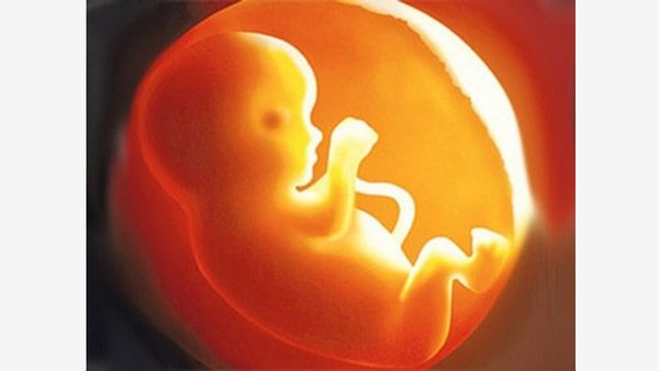 Bengaluru Police Arrest Doctor, Technician For Allegedly Performing 900 Illegal Abortions