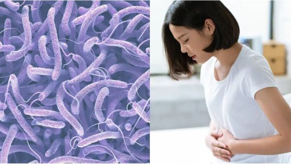 Cholera Outbreak In Bengaluru: Health Advisory Issued; Hotels To Serve Boiled Drinking Water