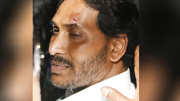Stone Attack On CM Jagan Mohan Reddy During Memantha Siddham Yatra In Vijayawada
