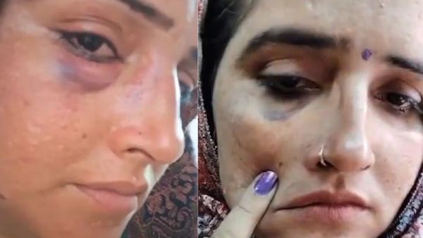 Fact Check: Was Seema Haider Assaulted By Her Husband Sachin Meena?
