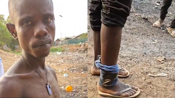 Sierra Leone Declares Emergency Due To Grave-Digging Addicts Using Human Bone Drug 'Kush'