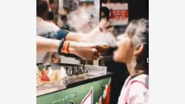 12-Year-Old Girl Gets Hole In Her Stomach After Eating Liquid Nitrogen Paan In Bengaluru