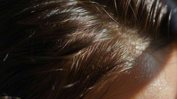 Scalp And Your Hair May Have A Deeper Connection Than You Think, Know How It Affects Hair Health And Growth!