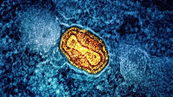 WHO Calls Emergency Meeting To Address Monkeypox Surge From Congo