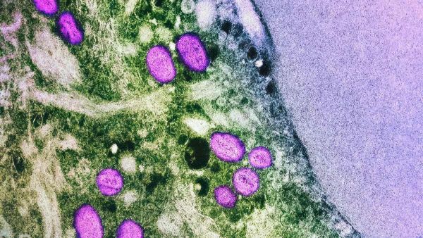 EXPLAINED: How Did The Mpox Outbreak Boost Bavarian Nordic's Profits?