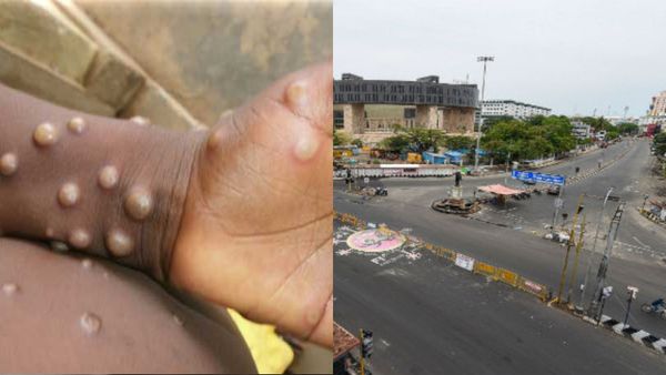 Monkeypox Lockdown: Will There Be Another Lockdown Imposed Again Due To Mpox?