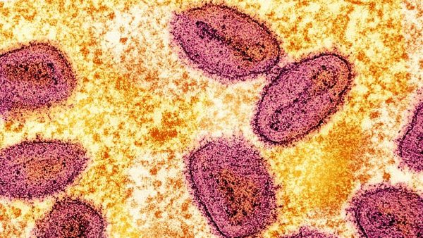 New Mpox Variant Detected: THESE 7 Countries Confirm Cases