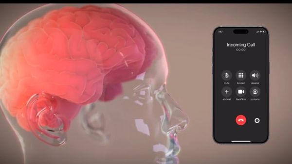 Neuralink's Second Human Trial Shows Promising Results