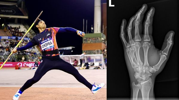Neeraj Chopra Played Diamond League Final With A Broken Hand, Shares X-Ray Report On Social Media