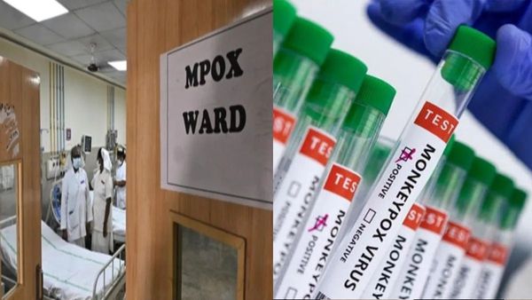 Monkeypox Symptoms Detected In Passenger At Trichy International Airport; Isolated