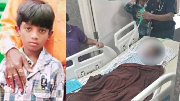 Pushpa 2 Stampede: Condition Of The Child Injured In Sandhya Theatre Incident Is Critical