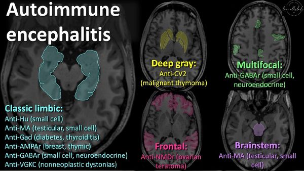 New Variant of HMPV Virus In China: Will Neurological Symptoms Be The Next Challenge?