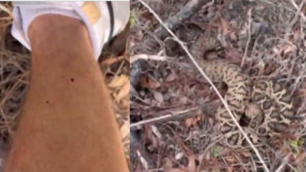 WATCH Video | Influencer Praises Florida's Deadliest Snake, Then Ends Up In ICU!