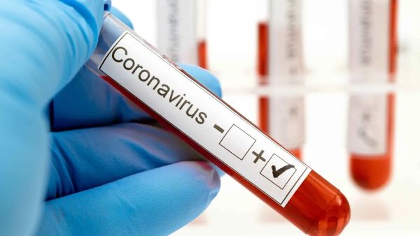 COVID-19 Cases In India Cross 3,000 Mark; Kerala, Maharashtra Top Chart