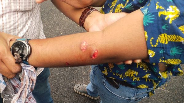 Bannerghatta Leopard Attack: 13-Year-Old Boy Injured During Safari as Big Cat Lunges Through Window