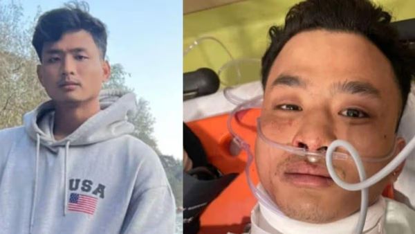 Anjel Chakma Death Case: Family Alleges ‘Chinese’ Slurs, Police Deny Racial Angle