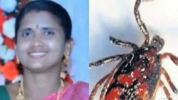 Andhra Pradesh Woman Dies of Suspected Scrub Typhus, 1,317 Cases Reported, Officials Calm Fears