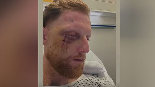 Ben Stokes Shares Post-Surgery Photo After Cricket Accident