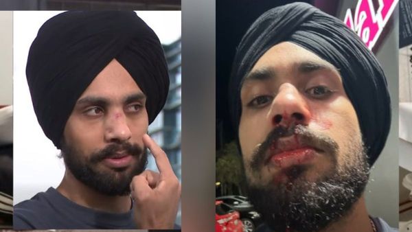 Racist Attack! 3 Men Beat Indian Sikh In Australia