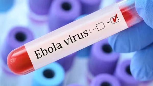Ebola Virus Alert! Gujarat Man Coming From Congo Quarantined in Ahmedabad