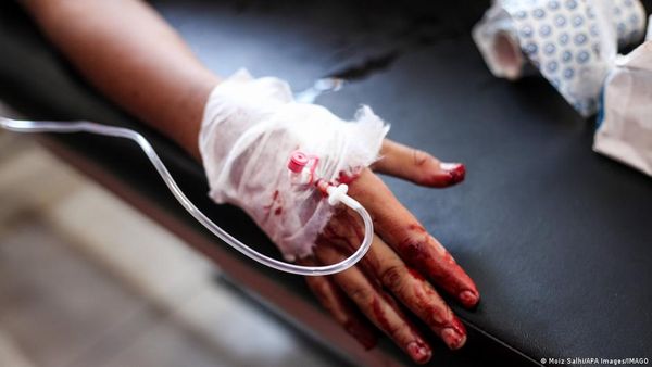 Gaza Officials Say Several Killed In Israeli Strike
