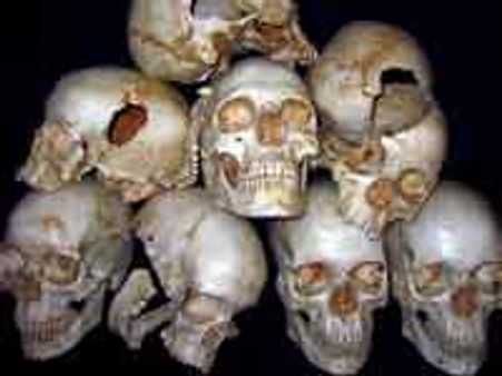 ಅಲಿಘರ್ ನ ಕೊಳದಲ್ಲಿ100 ತಲೆಬುರುಡೆ ಪತ್ತೆ!