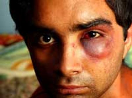 ಆಸ್ಟ್ರೇಲಿಯಾದಲ್ಲಿ ನಿಲ್ಲದ ಜನಾಂಗೀಯ ದಾಳಿ