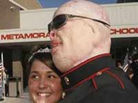 ಅವಳಿಗೆ ಮುಖ ಇಲ್ಲದವನೂ ಮುದ್ದಾಗಿ ಕಂಡ!