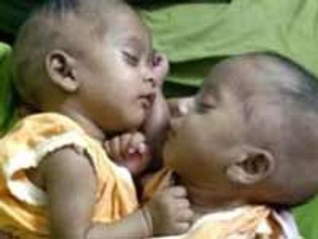 ಪೀಸ್ ಮತ್ತು ಪೇಷನ್ಸ್ ಬೇರ್ಪಡಿಸಿದ ವೈದ್ಯರು