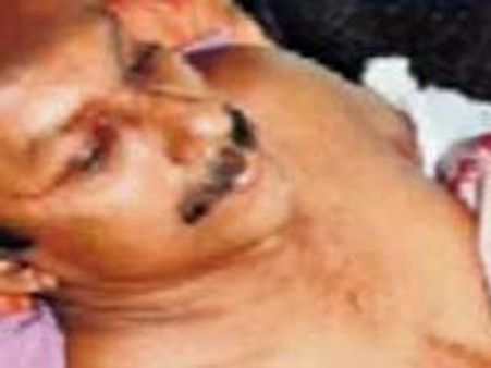 ಕೇರಳ : ಬಲಗೈಯನ್ನೇ ಕತ್ತರಿಸಿದ ಮುಸ್ಲಿಮರು