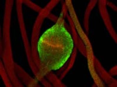 'ಬೌಲೆ' ಎಂದರೆ ಏನು ಗೊತ್ತೇ?