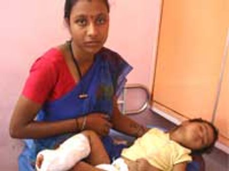 ಈ ಮಗುವಿನ ಹೆಚ್ಚಿನ ಚಿಕಿತ್ಸೆಗಾಗಿ ನೆರವು ನೀಡಿ