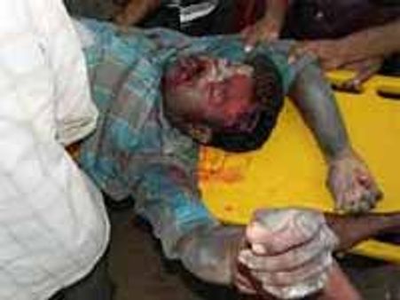 ಕಲ್ಲುಕ್ವಾರಿಯಲ್ಲಿ ಬರೆಕುಸಿತ ಎರಡು ಜೀವ ಬಲಿ