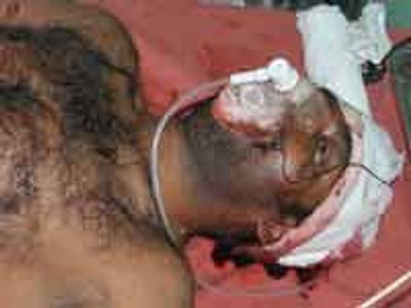 ದ್ವೇಷದ ಜ್ವಾಲೆಗೆ ಬಳ್ಳಾರಿ ಯುವಕ ಗೋಪಾಲ್ ಬಲಿ